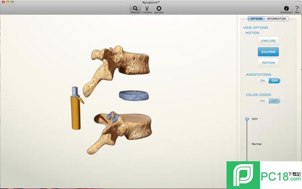 spineformac