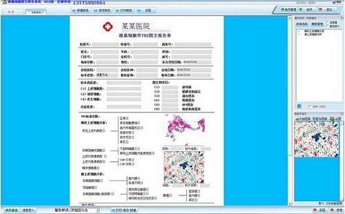 巨渺液基图文报告