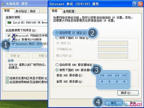 Win7系统宽带正常却打不开网页(1)